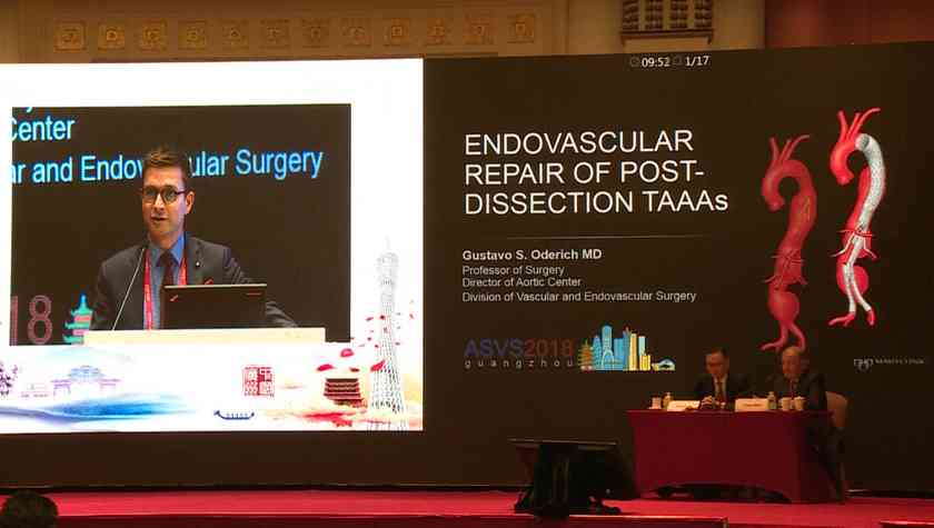 Gustavo S：ENDOVASCULAR PEPAIR OF POST-DISSECTION TAAAS